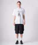 Anxiety. TEE