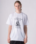 Anxiety. TEE