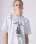 Anxiety. TEE